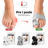 Separator ispravljač čukljeva
